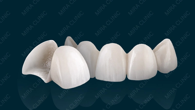 Natural Veneers in Turkey 